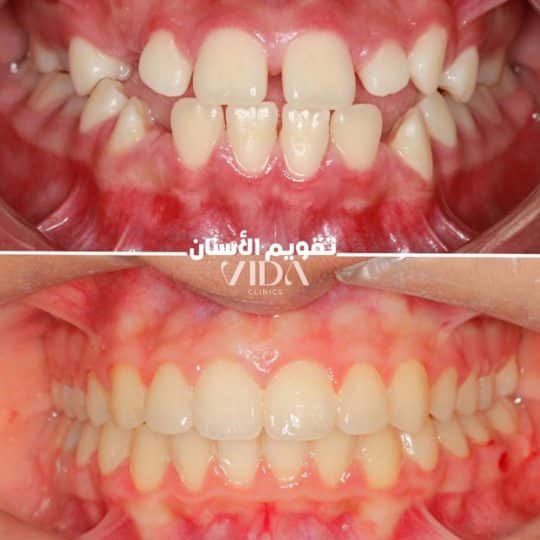 حالات اسنان قبل وبعد