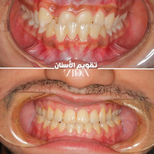 حالات اسنان قبل وبعد
