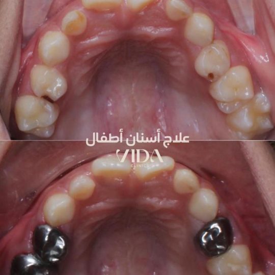 حالات اسنان قبل وبعد