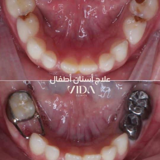 حالات اسنان قبل وبعد