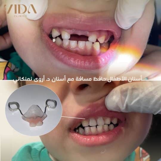 حالات اسنان قبل وبعد