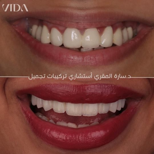 حالات اسنان قبل وبعد