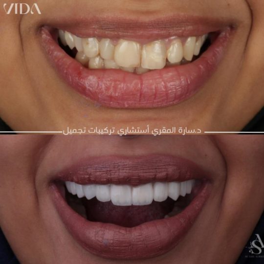 حالات اسنان قبل وبعد