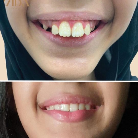 حالات اسنان قبل وبعد14