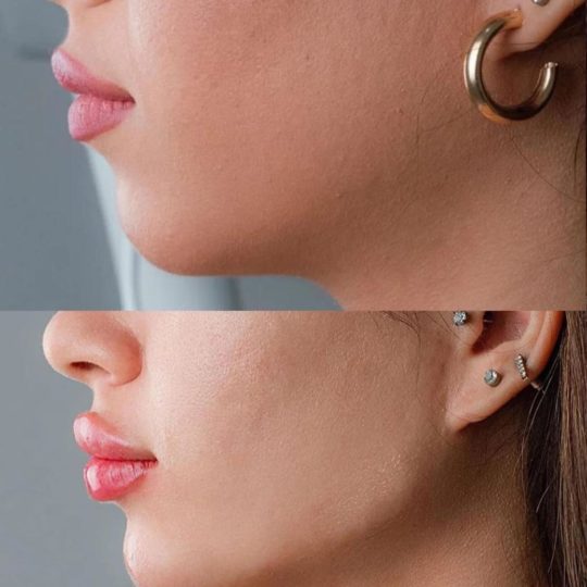 حالات تجميل قبل وبعد