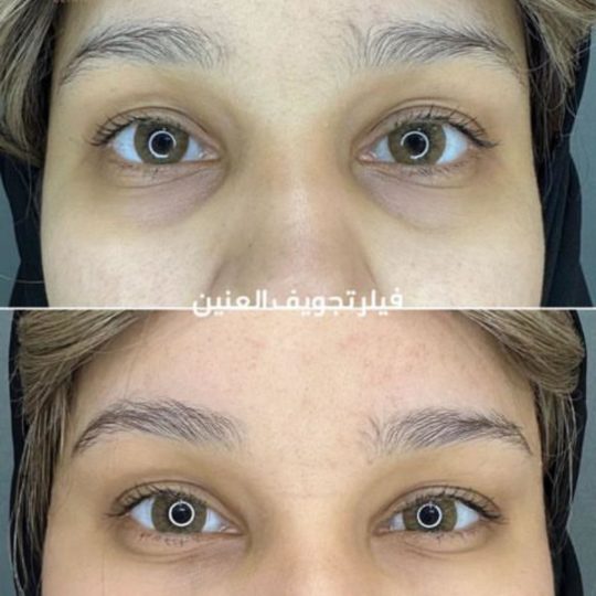 حالات تجميل قبل وبعد