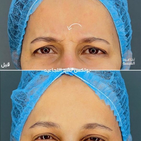 حالات تجميل قبل وبعد