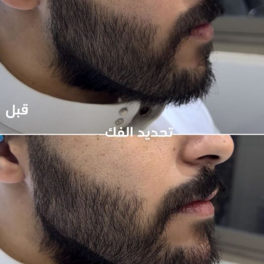 حالات تجميل قبل وبعد