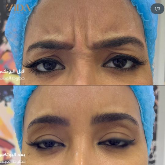 حالات تجميل قبل وبعد