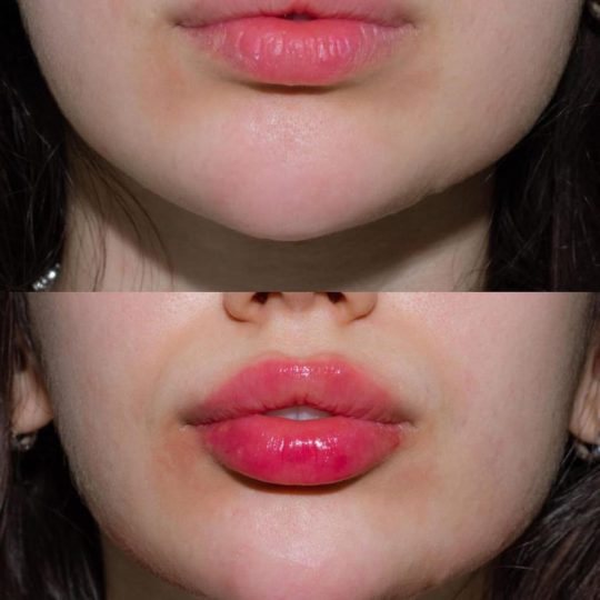 حالات تجميل قبل وبعد