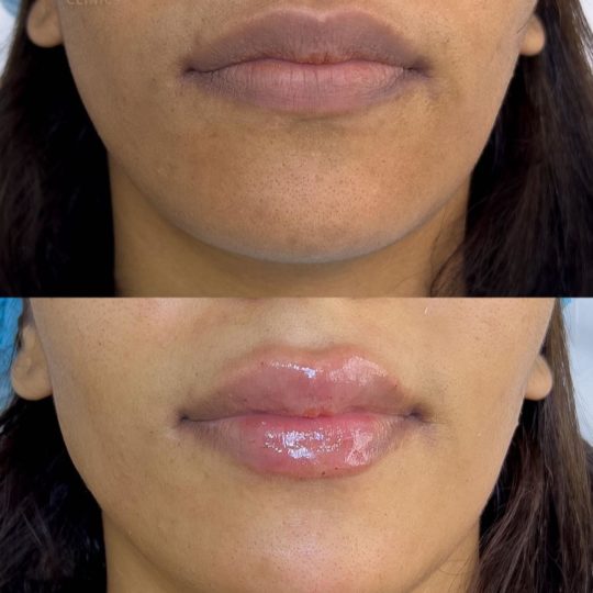 حالات تجميل قبل وبعد