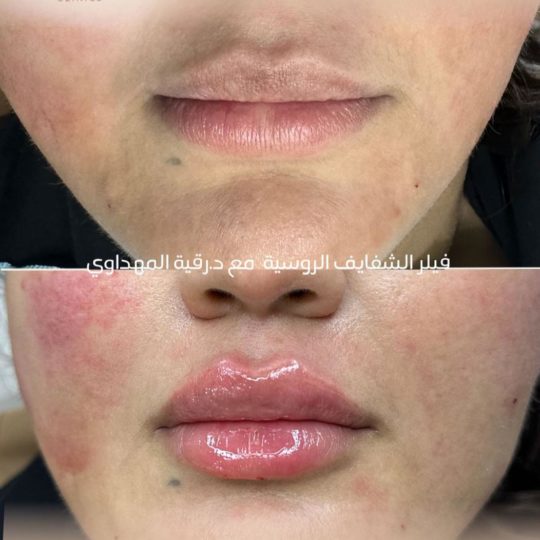 حالات تجميل قبل وبعد
